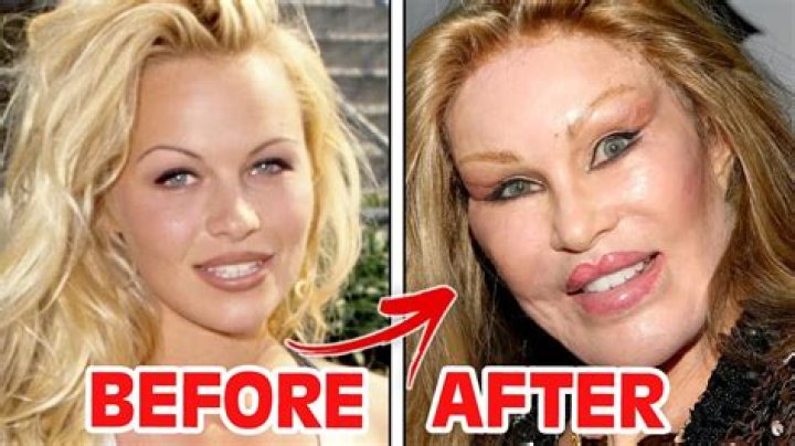 All About Lojain Omran Plastic Surgery With Her Before And After Photos ·