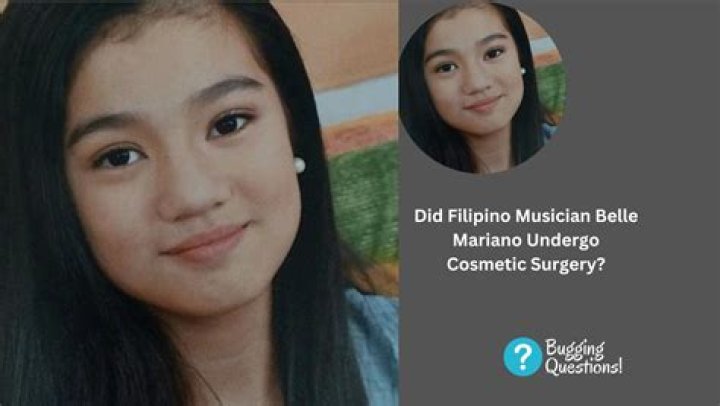 Belle Mariano Before And After Plastic Surgery Pics, Age And Husband Revealed