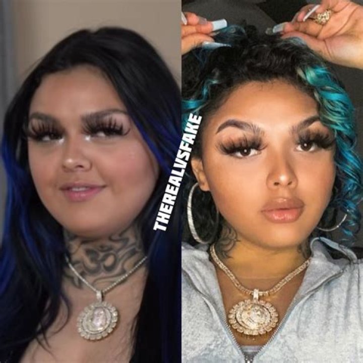 Blueface Mom BBL Surgery: Before And After Photos