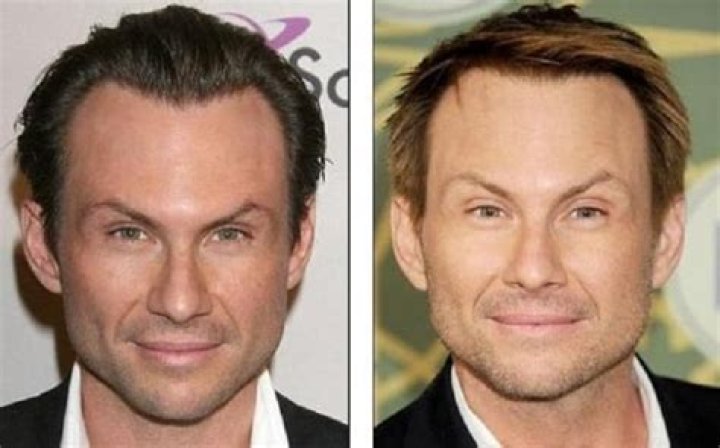 Christian Slater Plastic Surgery Before and After