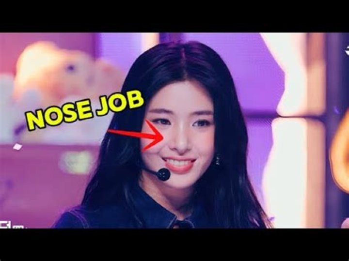 Did She Get Nose Job?