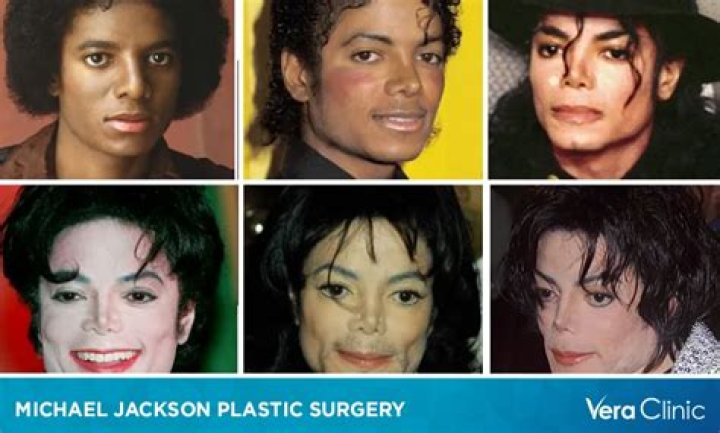 Insider Secrets Of His Plastic Surgery Journey