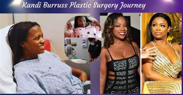 Kandi Burruss Plastic Surgery: Procedures, Costs, and More