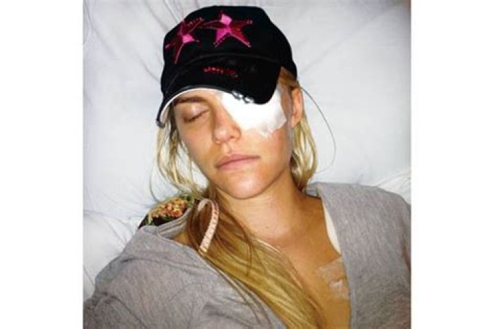 Lauren Scruggs Before Accident Photos, Where Is She Now? Hospitalized
