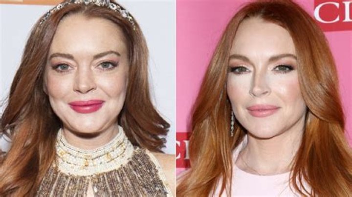 Lindsay Lohan's Plastic Surgery Transformation: A Closer Look