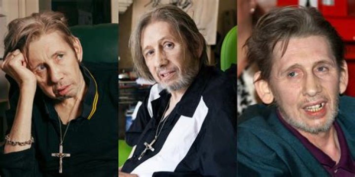 Shane Macgowan Teeth History