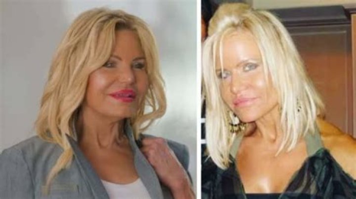 Unveiling Lisa Helou's Transformation: Pre-Plastic Surgery Insights
